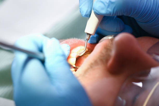 Best Dentist for Dental Trauma  in Colstrip, MT