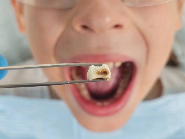 Best Teeth Whitening  in Colstrip, MT
